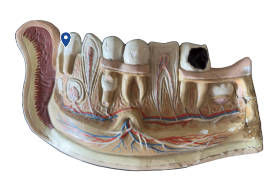 <p>Name this tooth type.</p>