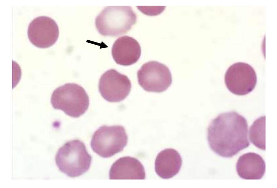 <p>Name this RBC</p>