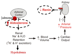<p>adenoma in adrenal cortex pumps out aldosterone. kidneys sense elevated aldosterone levels and stop secreting renin (angiotensin I is not activated), but aldosterone levels remain high.</p>