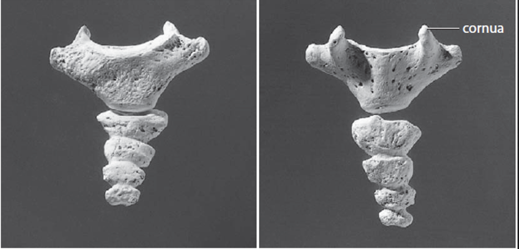<p>What bone is this?</p>