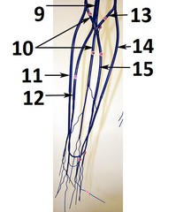 <p>13</p>