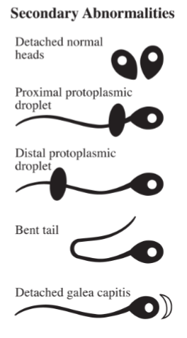 <ul><li><p>Detached normal heads</p></li><li><p>Proximal protoplasmic droplet</p></li><li><p>Distal protoplasmic droplet</p></li><li><p>Bent tail</p></li><li><p>Detached galea capitis</p></li></ul><p></p>