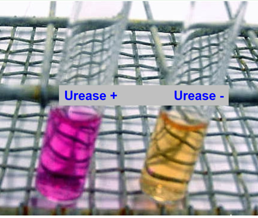 <p>Urea Broth positive result</p>