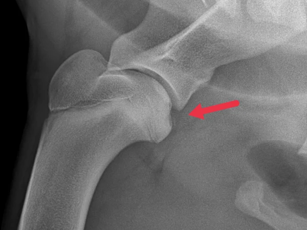 <p>Joint mouse</p>