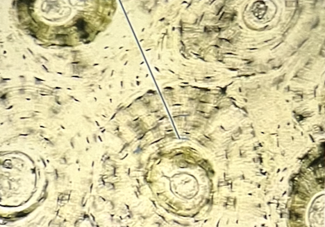 <p>identify the specific tissue</p><p>a. dense regular CT</p><p>b. osseous tissue</p><p>c. elastic cartilage</p><p>d. blood</p><p>e. reticular CT</p>