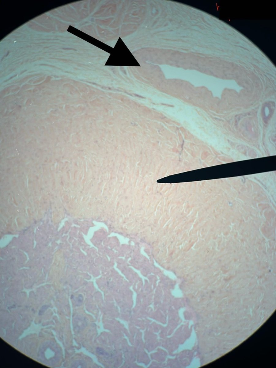 <p>• (immediately surrounds the urethra)</p><p>• has one; engorges with some blood</p>
