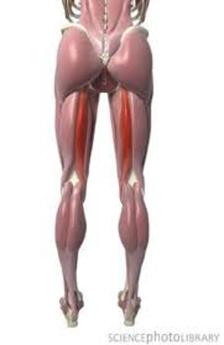 <p>What is this and what does it do? Give an origin and insertion.</p>