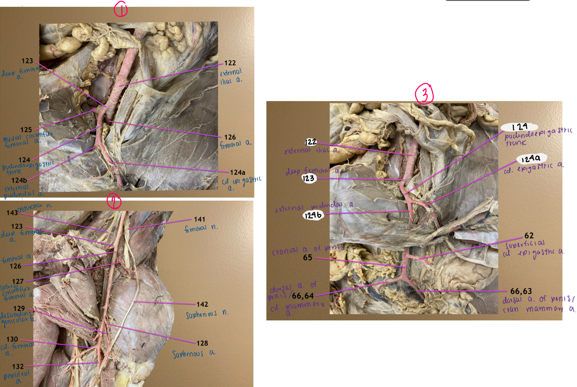 <ol start="129"><li><p>descending genicular a.</p></li><li><p>caudal femoral a.</p></li></ol><ol start="132"><li><p>popliteal a.</p></li></ol><p></p>