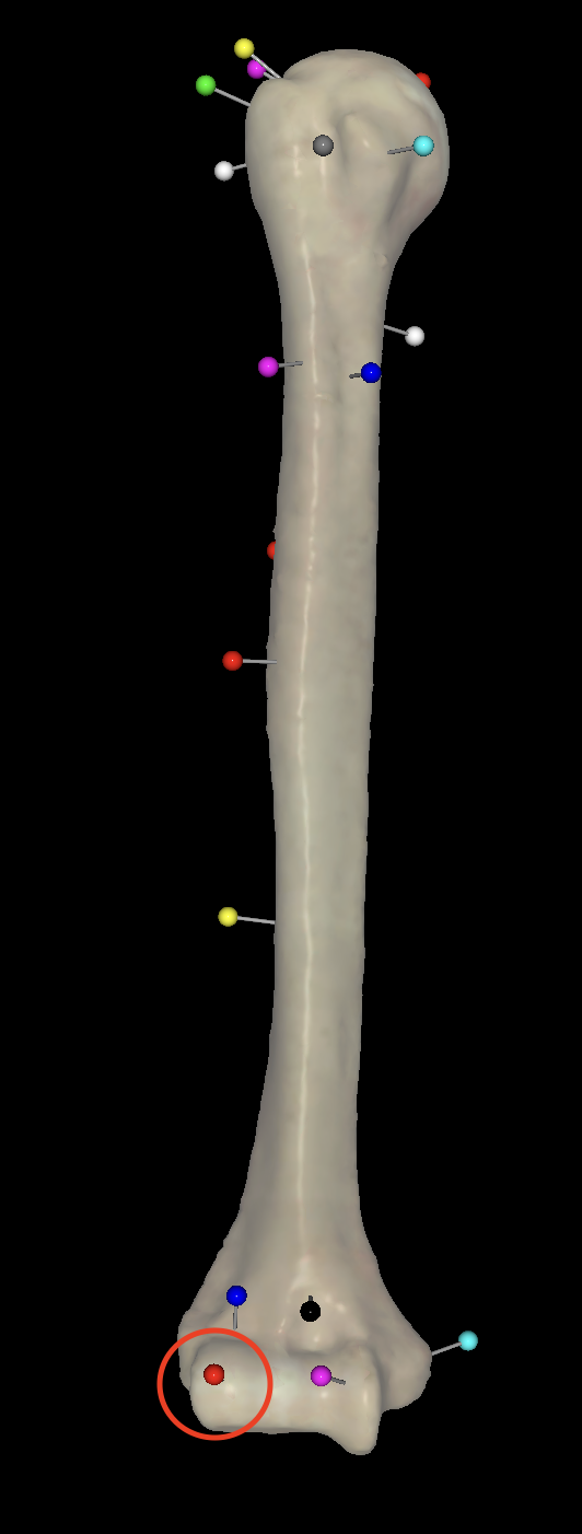 <p>What is the circled pin called on the right humerus?</p>