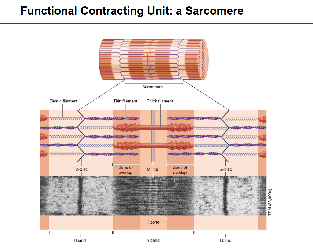 <p>Identify portions of Sarcomere</p>
