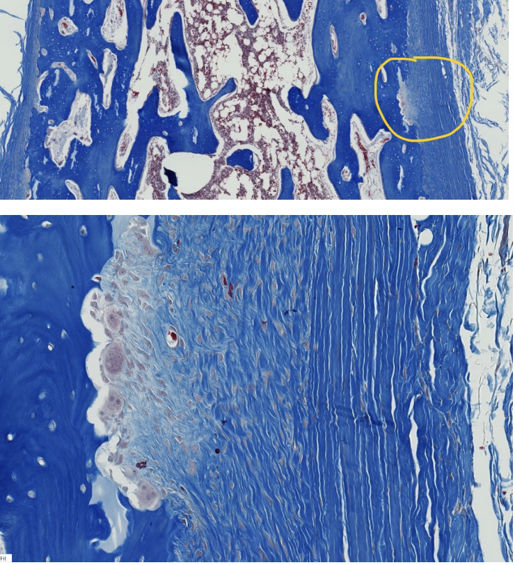 <p>The upper image is fill thickness through the shaft of a long bone, with the external surfaces on the left and right sides of the image.</p><p>The encircled area in the upper image is enlarged in the lower image. </p><ol><li><p>What do we call the encircled external fibrous membrane (outer CT covering) of bone?</p></li><li><p>What does fibrous refer to in this context?</p></li></ol><p></p>