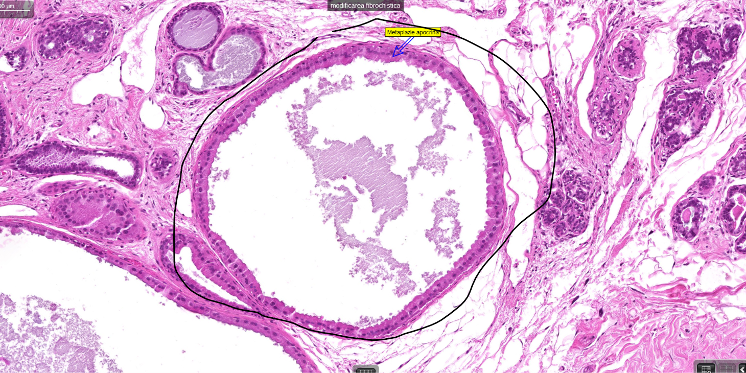 term image