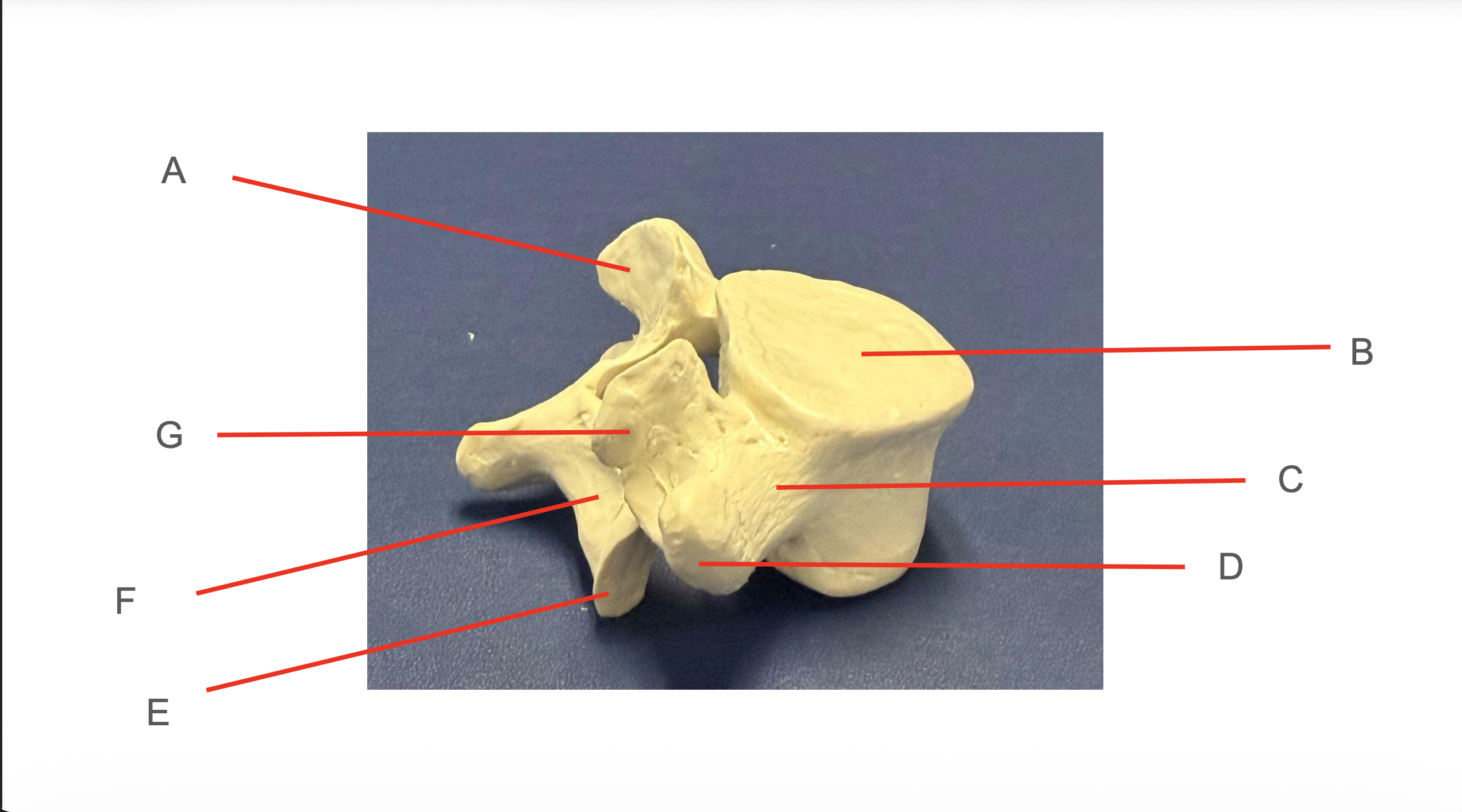<p>Identify Structure E </p>
