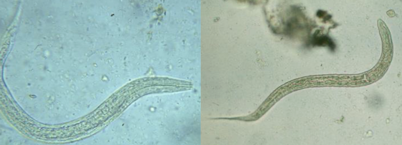 <p>what helminth is this?</p>