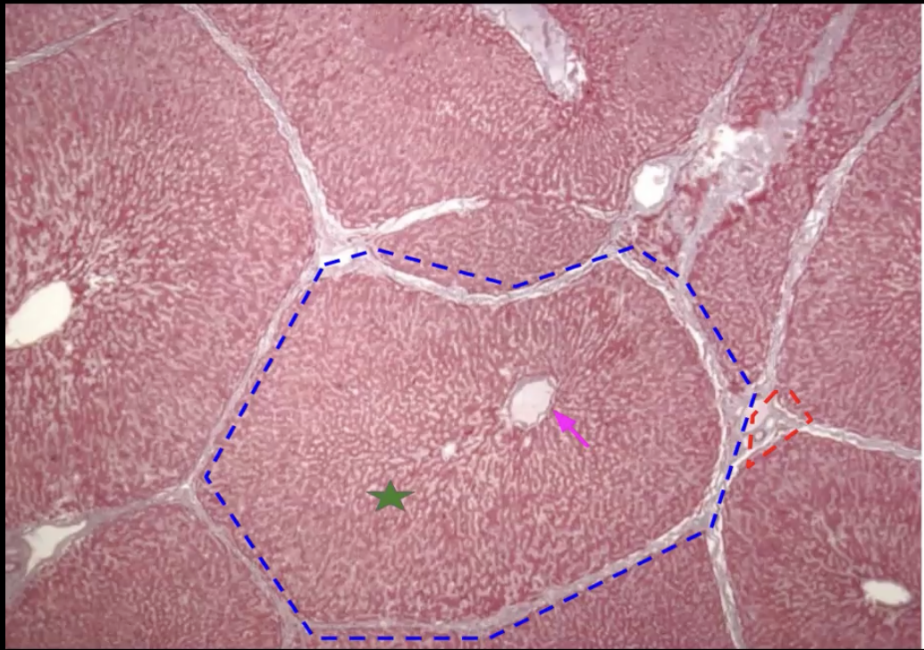 <p>What organ is this? identify. What makes up the structure in red?</p>