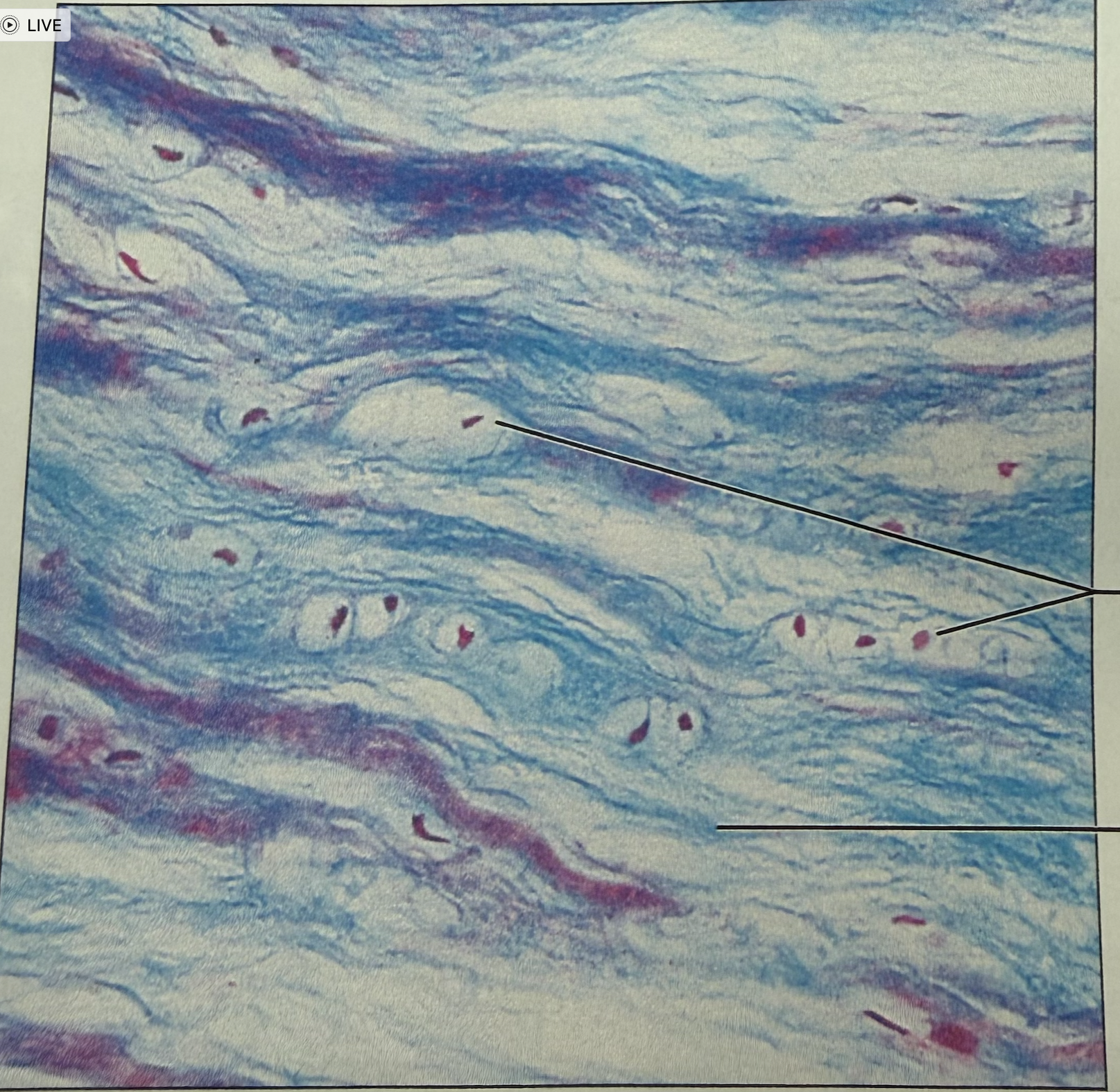 <p>what tissue is this</p>