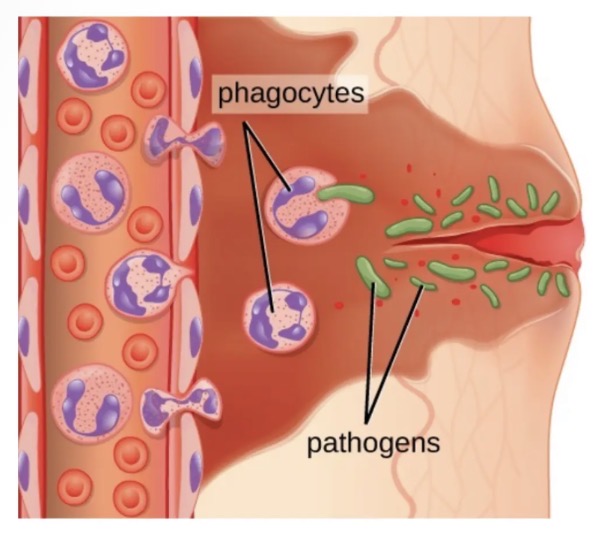 <ul><li><p>Complement system proteins and other chemicals released by the mast cells will attract macrophages and leucocytes(mainly neutrophils) to the area. They will engulf and destroy the pathogens by phagocytosis.</p></li><li><p>Changes in the tissues will stimulate the pain receptors causing the person to feel pain.</p></li><li><p>Leucocytes (mainly neutrophils) will die as they fill with bacteria / debris = yellow fluid called pus forms.</p></li><li><p>When the response is successful in removing the pathogen = tissue repair and healing will occur via mitosis.</p></li></ul><p></p>