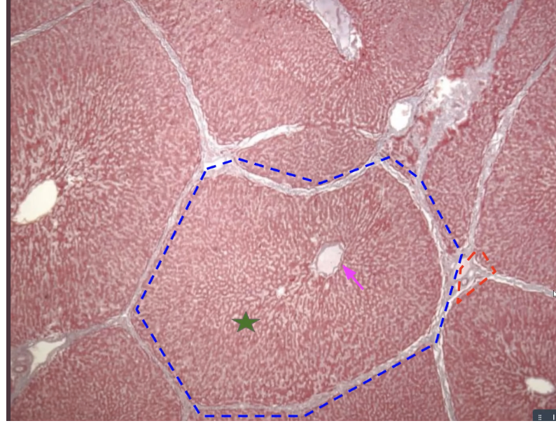 <p>label the liver</p>