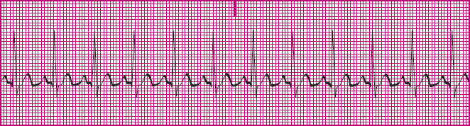 <p>What rhythm is this?</p>