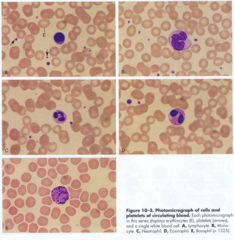 <p>Stain commonly used for blood smears and bone marrow to differentiate blood cells.</p>