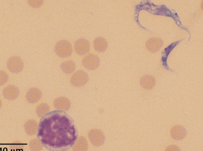 <p>How can you differentiate between a pathogenic vs a nonpathogenic trypanosomes/trypomastigotes?</p>