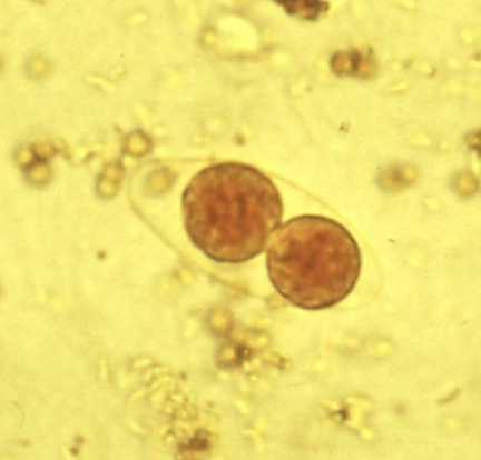 <p>What parasite is this?</p>