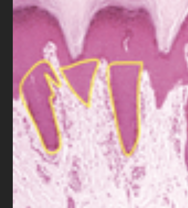 <p>The parts of the epidermis that extend into the dermis </p>