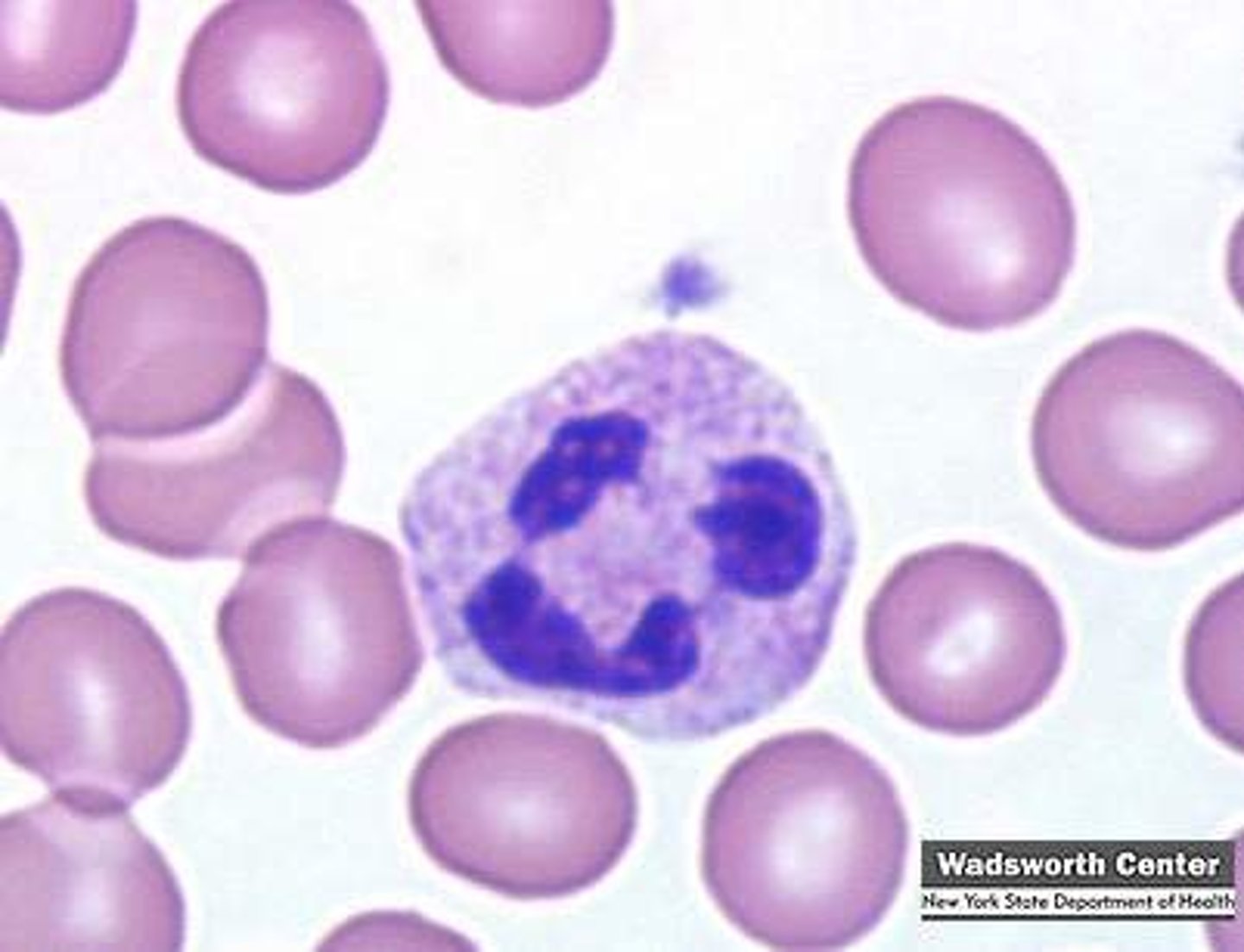 <p>granulocytic leukocyte formed in bone marrow. it is a phagocytic tissue fighting cell. also called a polymorphonuclear leukocyte</p>