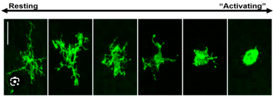 <p>Retract all the long processes </p>