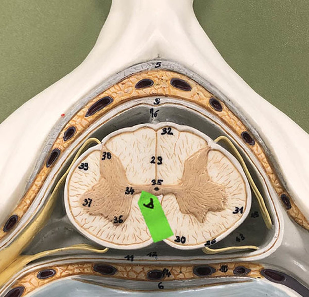 <p>Identify this structure.</p>