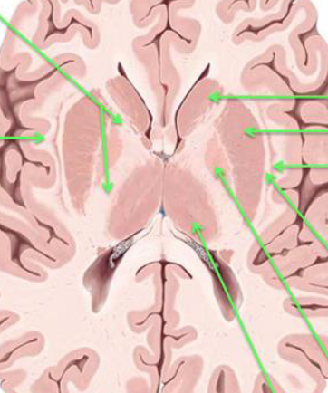 <p>Can you label all the green arrows on this image?</p>