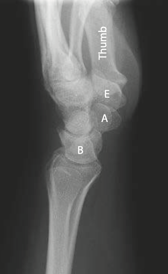 <p>E</p>