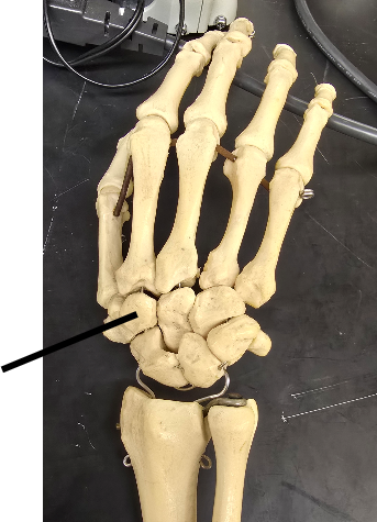 <p>Name Carpal Bone</p>