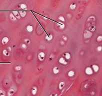 <p>hyaline cartilage</p>