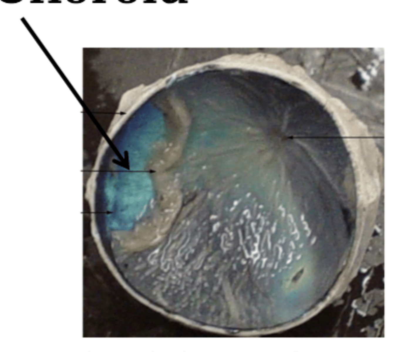 <p>-middle vascular layer</p><p>-deep to sclera</p><p>-superficial to retina</p>
