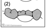 <p>modified hygienic</p>