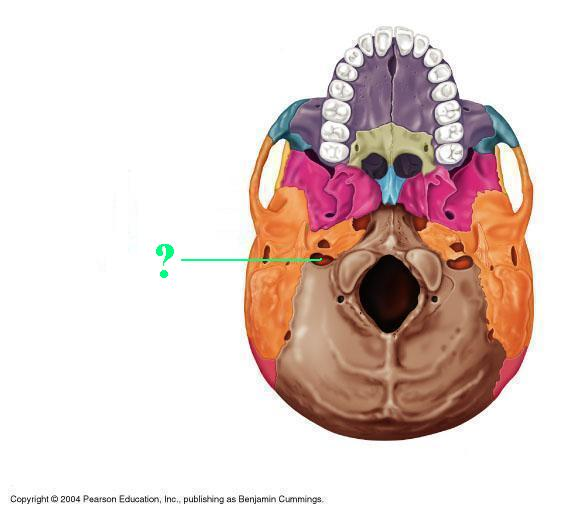<p>Identify the indicated bone marking (opening)</p>