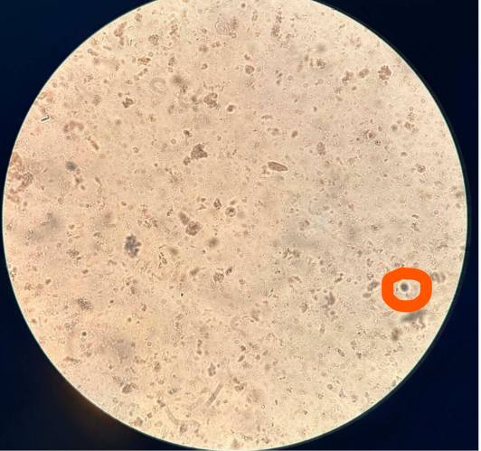 <p>Endolimax nana cyst</p>
