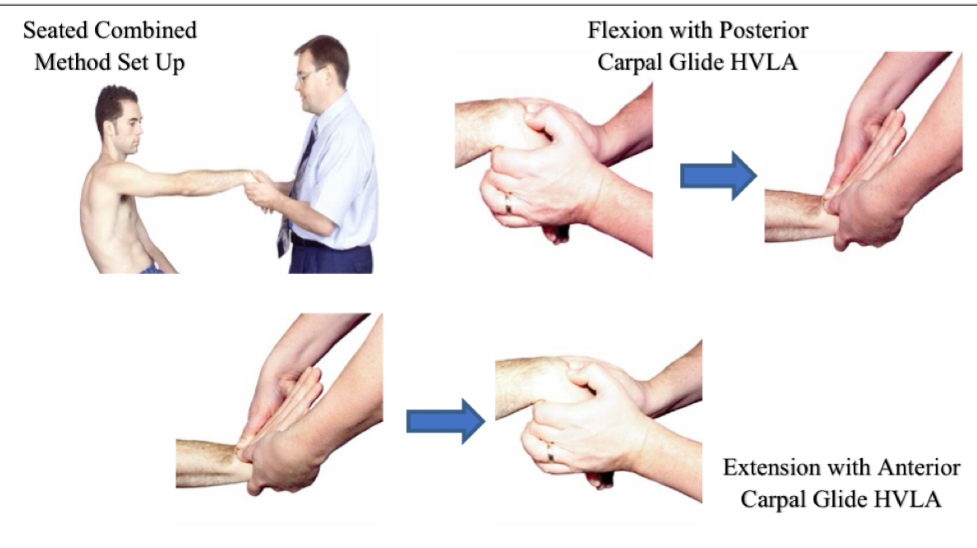 <ol><li><p>Pt seated, physician faces pt</p></li><li><p>Hold wrist like dx</p></li><li><p>Extend/flex into barrier while maintaining pressure</p></li><li><p>pt will lean back for slightly back for traction</p></li><li><p>Thrust is baby whip into barrier</p></li></ol><p></p><p>Flex SD w posterior glide</p><p>Extension SD w anterior glide</p>