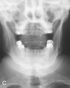 <p>AP Open Mouth: Is this Image Good?</p>