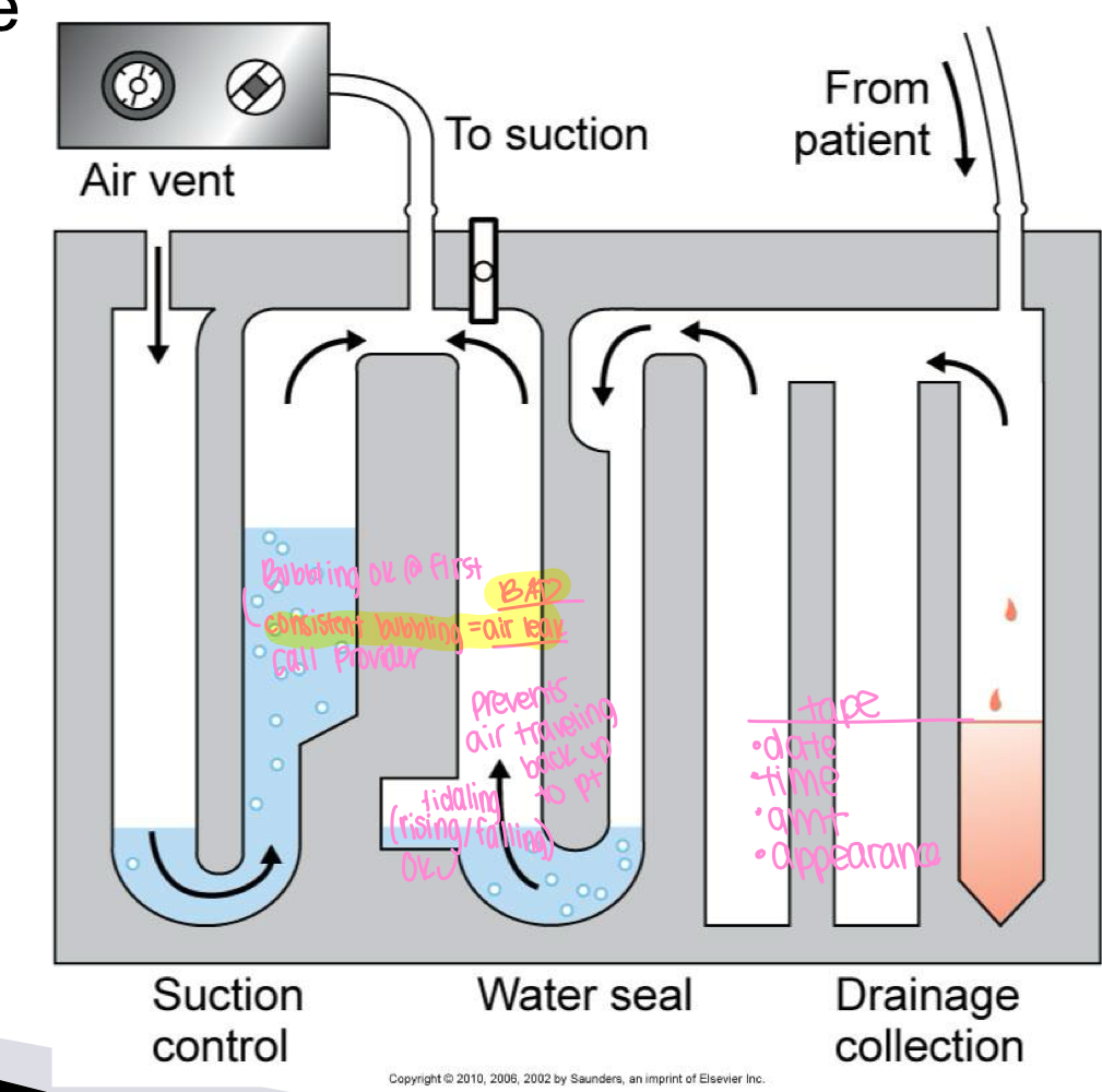 <p>chest tube drainage system</p>
