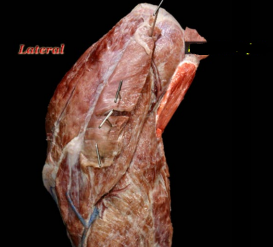 <ol><li><p>origin </p></li></ol><p>caudal border of scapula</p><ol start="2"><li><p>insertion</p></li></ol><p>teres major tuberosity</p><ol start="3"><li><p>action</p></li></ol><p>flexes the shoulder joint</p><p></p>