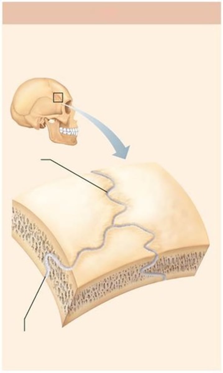 <p>Rigid, interlocking joints of the skull that allow for growth during youth</p>
