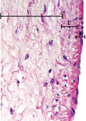 <p>What layer of the medium vein is labeled 1?</p>