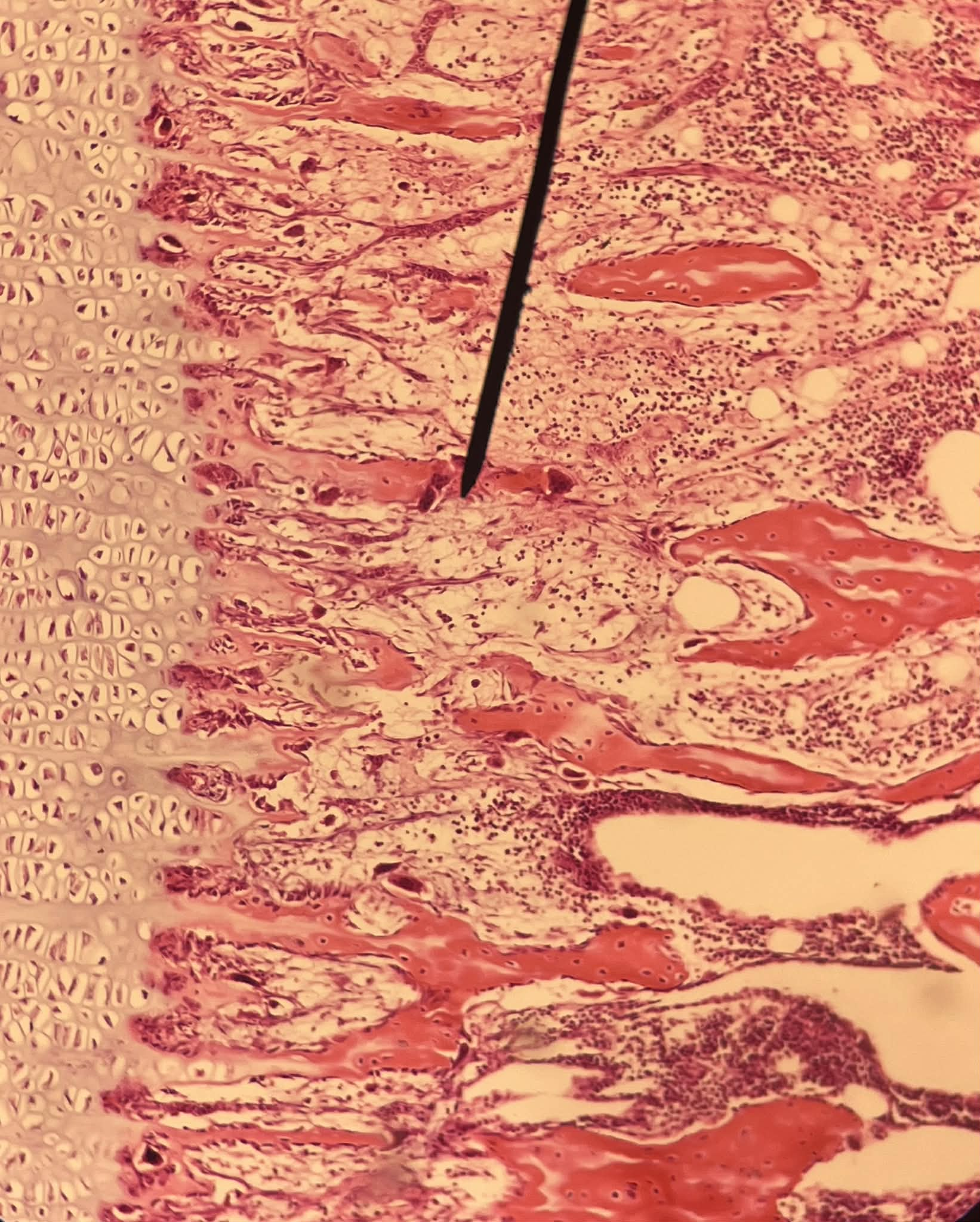 <p>Tiêu bản gì ?</p>