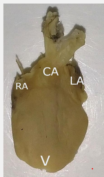 <ul><li><p>double</p></li><li><p>2 atria and a single ventricle</p></li><li><p>spiral valve</p></li></ul><p></p>