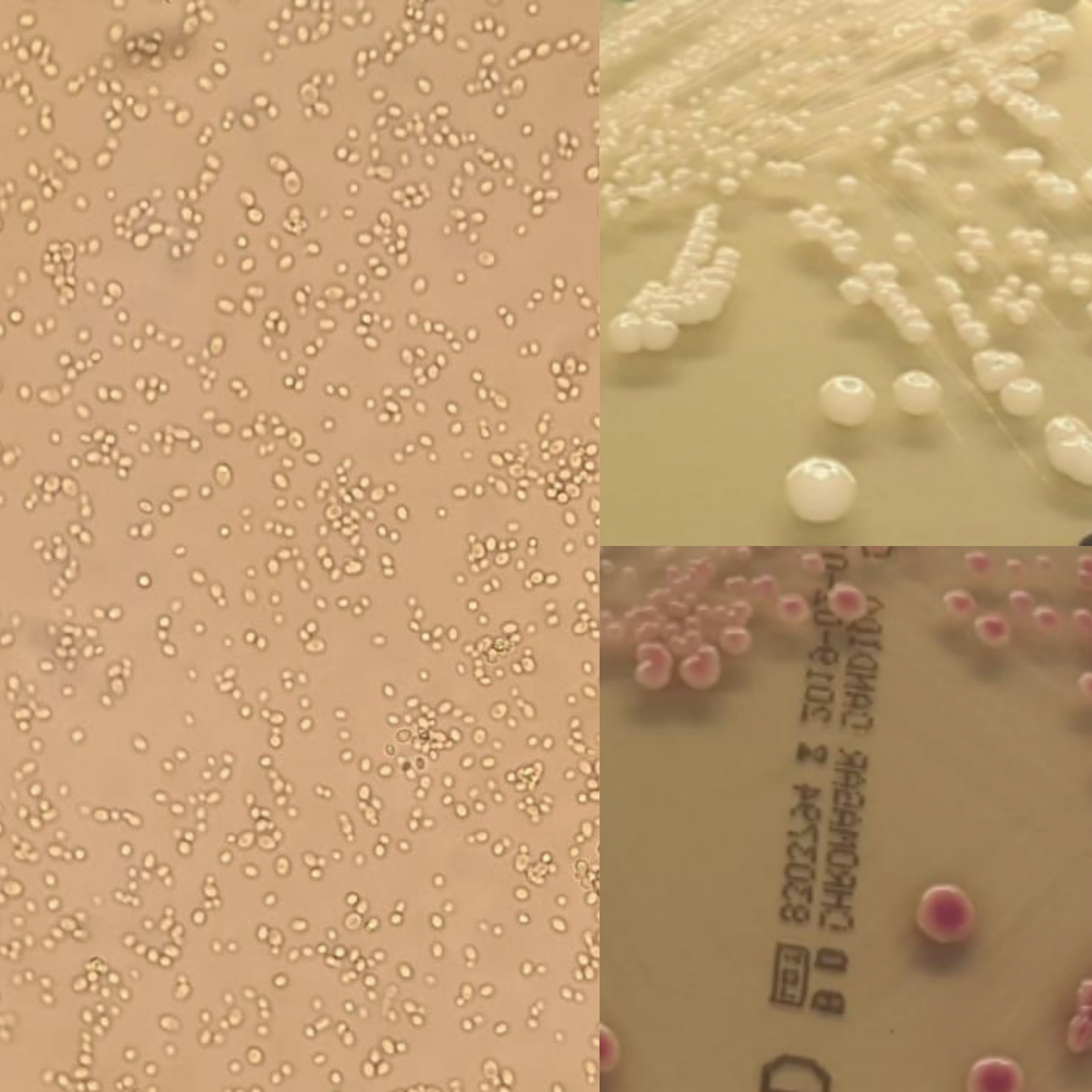 <p>Identifica a levedura pelos resultados nas provas de identificação:</p><p class="has-focus">Prova dos clamidosporos: -</p><p class="has-focus">Prova da filamentaçao: -</p><p class="has-focus">Prova dos ascosporos: -</p><p class="has-focus">Prova da urease: -</p><p class="has-focus">Prova da fenoloxidase: -</p><p class="has-focus">Sensibilidade à cicloheximida: -</p><p class="has-focus">Cor no meio de chromagar Cândida: rosa</p><p class="has-focus">Análise macroscopica: aspeto cremoso com cor branca creme e com bordos regulares, normalmente com colónias pequenas convexas</p>