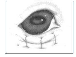 <p>Temporary what procedure is an option to treat entropion in puppies and spastic entropion? It uses vertical mattress sutures and non-absorbable suture or staples.</p>