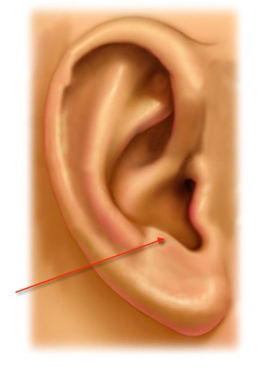 <p>small eminence on the upper margin of the lobe</p>