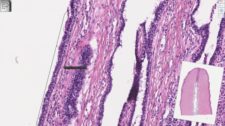 <p>cow teat</p>